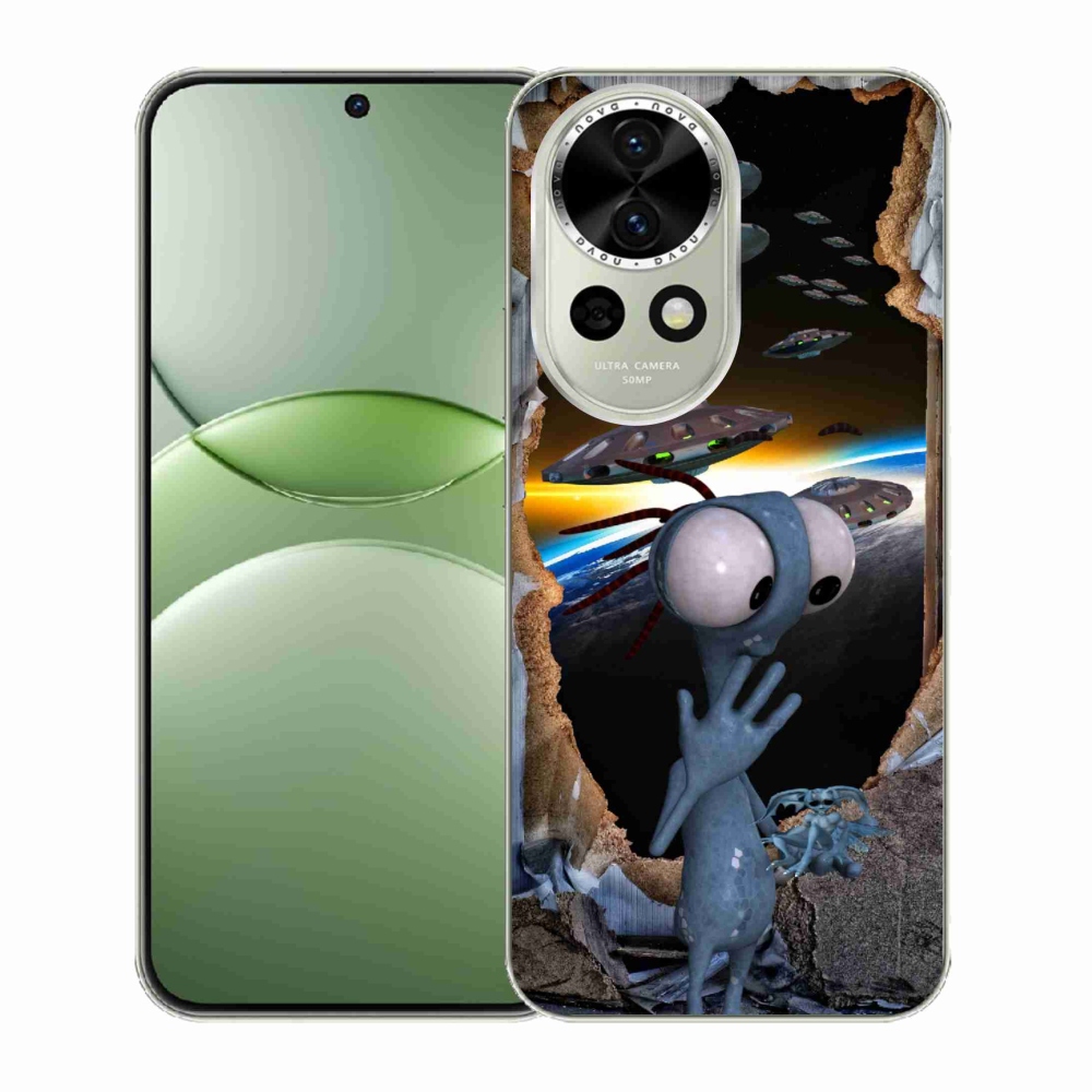 Gél borítás mmCase a Huawei Nova 13 5G-n - külföldiek