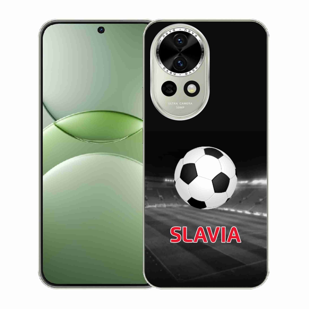 Gél borítás mmCase a Huawei Nova 13 5G-n - slavia