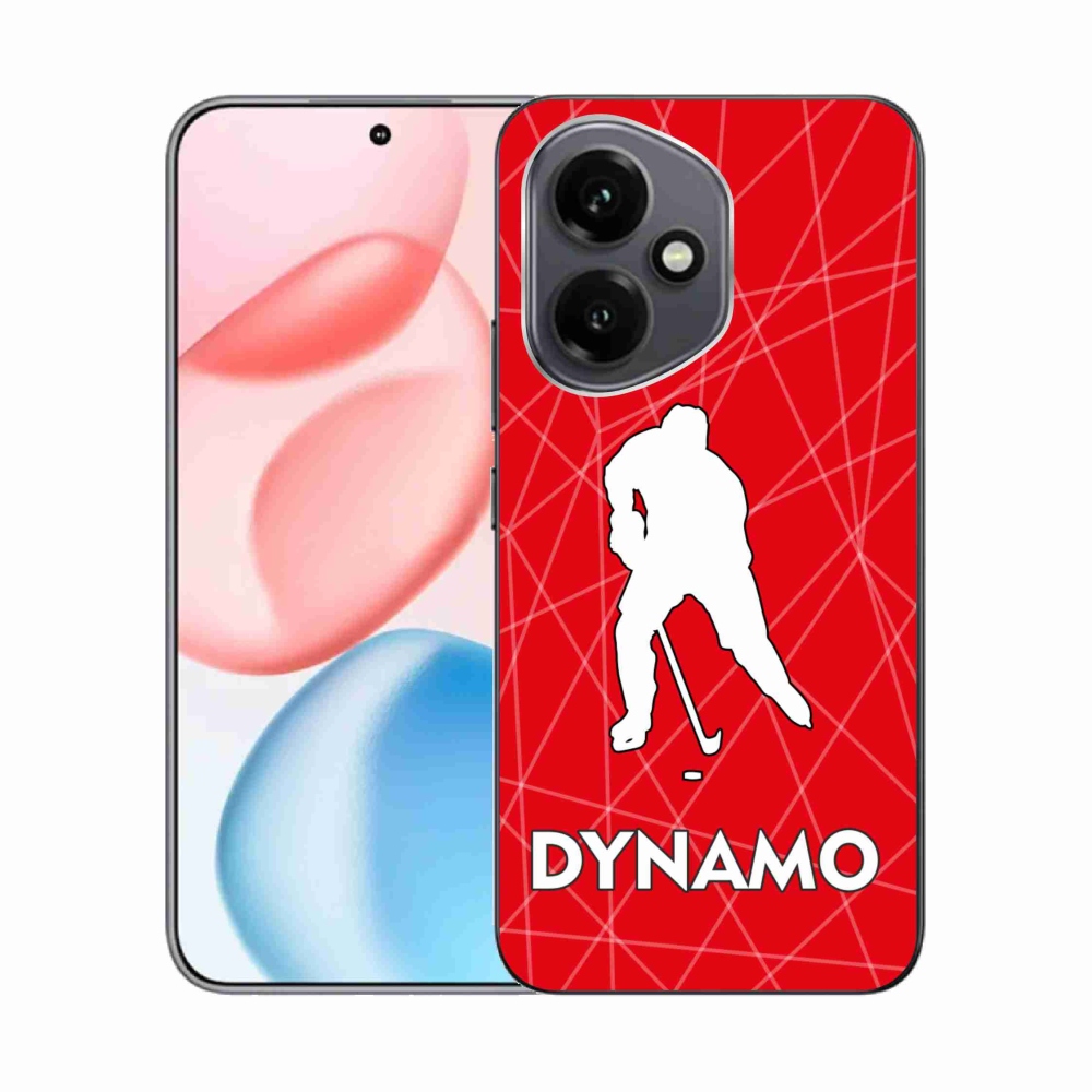 Zselés borítás mmCase a Honor 400-hoz - Dynamo 2