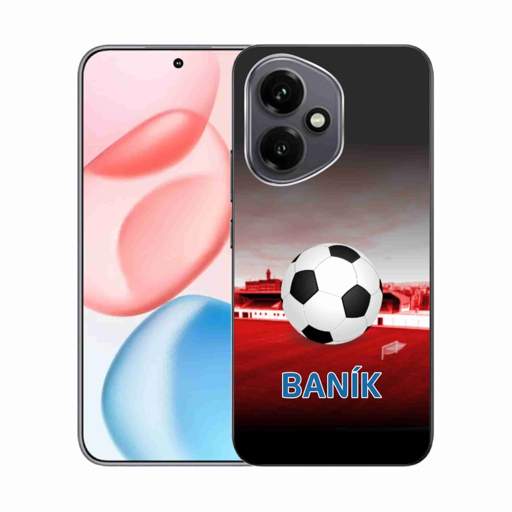 Gélfedél mmCase a Honor 400 - minerhez 1