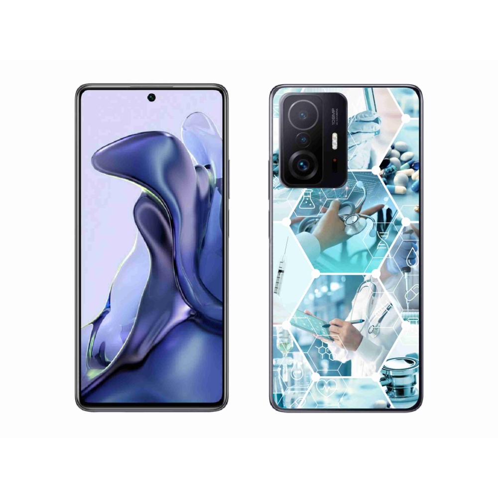Gélburkolat mmCase a Xiaomi 11T számára - egészség