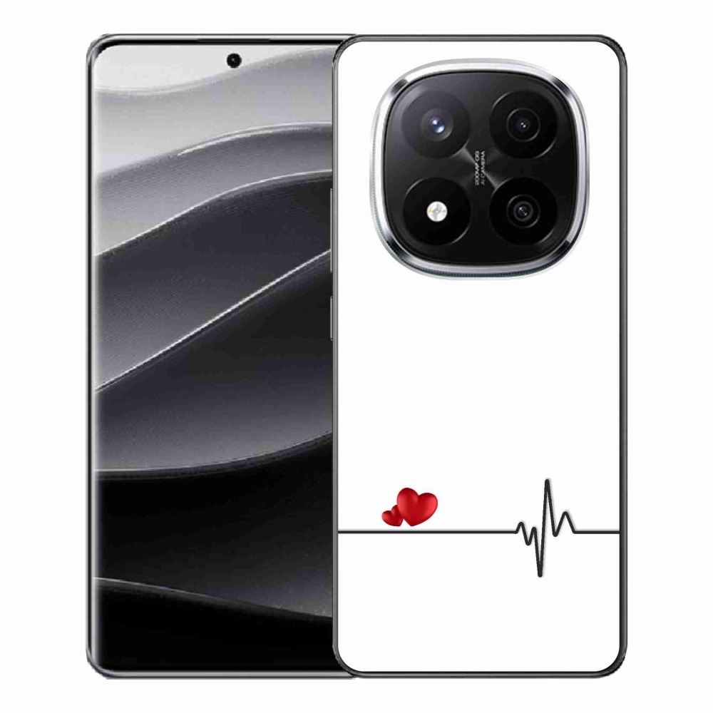 Gél borító mmCase a Xiaomi Redmi Note 14 Pro+ 5G számára - szív és szívverés fehér háttérrel