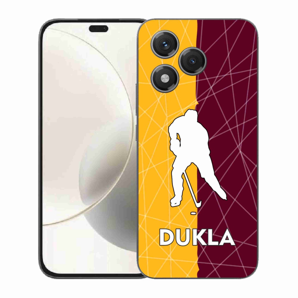 Zselés borítás mmCase a Honor 400 Lite-hoz - Dukla