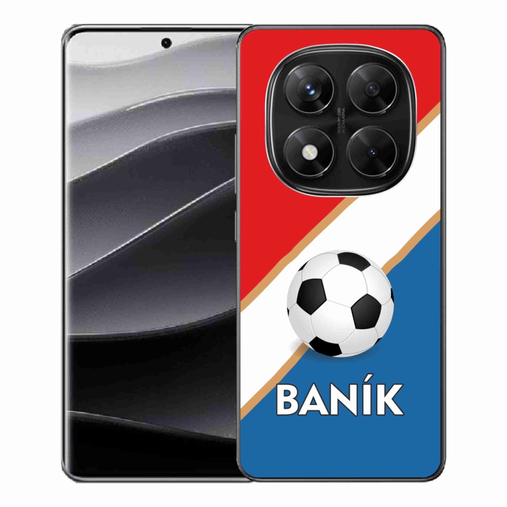 Zselés borítás mmCase a Xiaomi Redmi Note 14 Pro 5G/Poco X7 5G számára - Baník