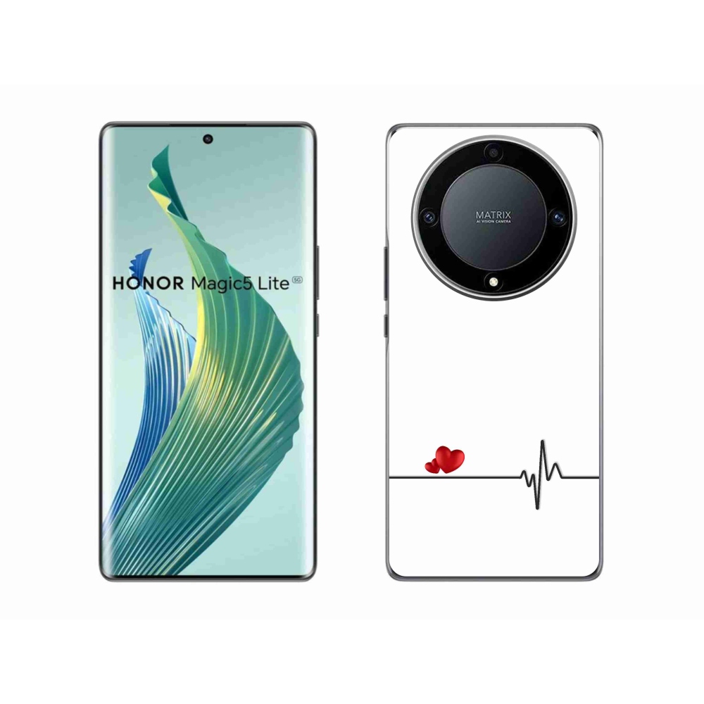 Gél borító mmCase a Honor Magic 5 Lite 5G készülékhez - szív és szívverés fehér háttérrel