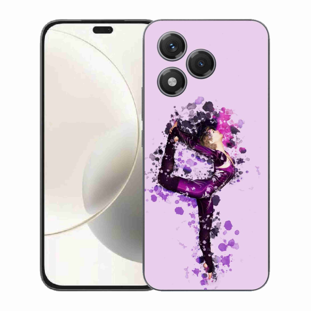 Zselés borítás mmCase a Honor 400 Lite-hoz - balett