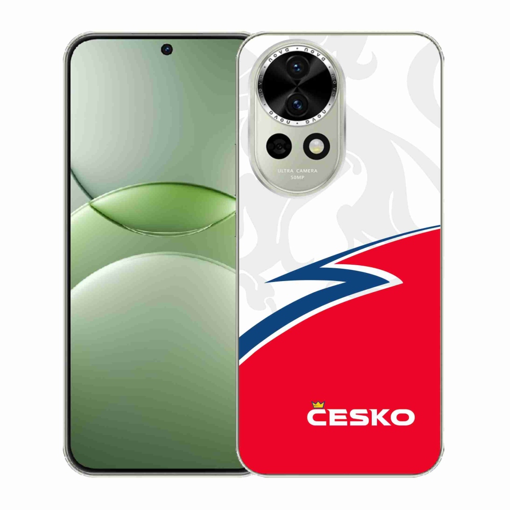 Gél védőhuzat mmCase a Huawei Nova 13 5G készülékhez - Csehország 1