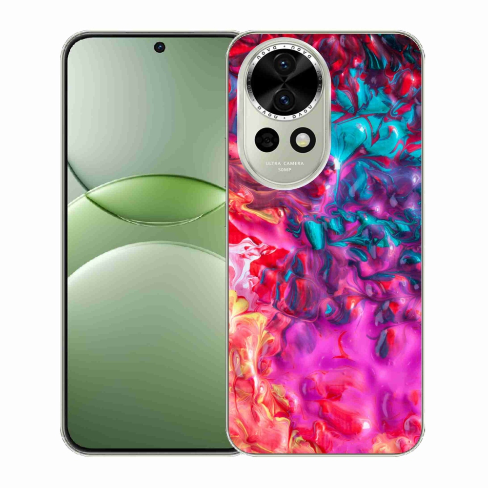 Gél borítás mmCase a Huawei Nova 13 5G-n - kivonat 27