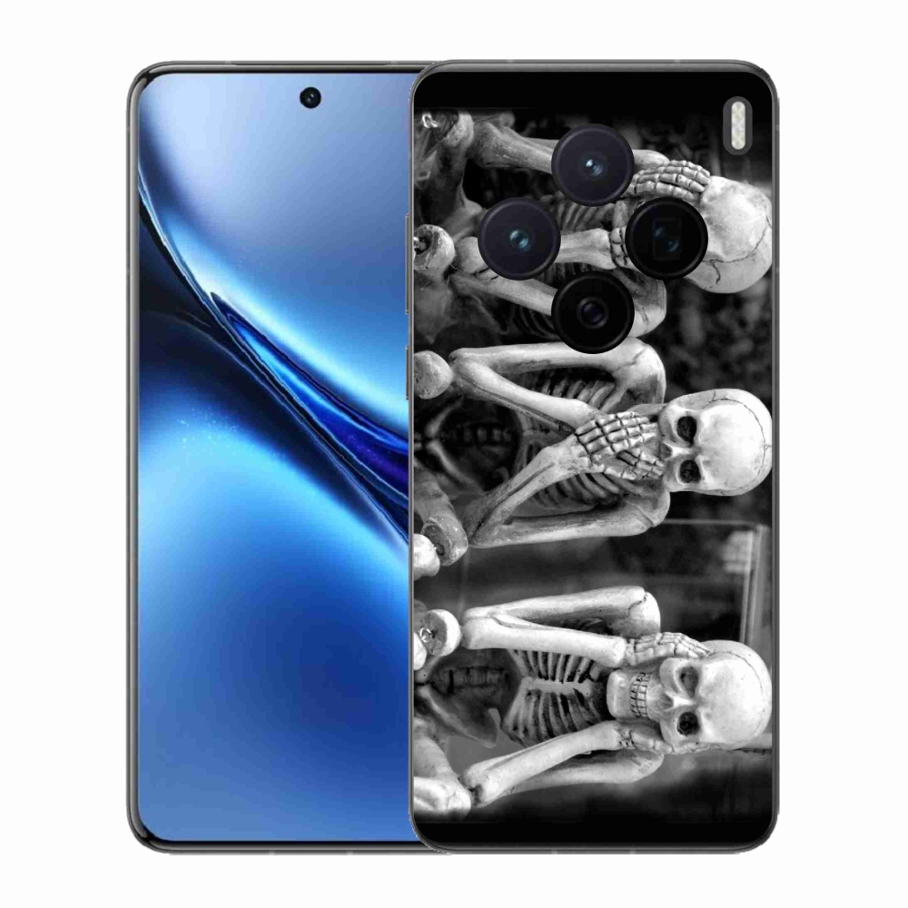 Zselés borítás mmCase a Vivo X200 5G-hez - csontvázak