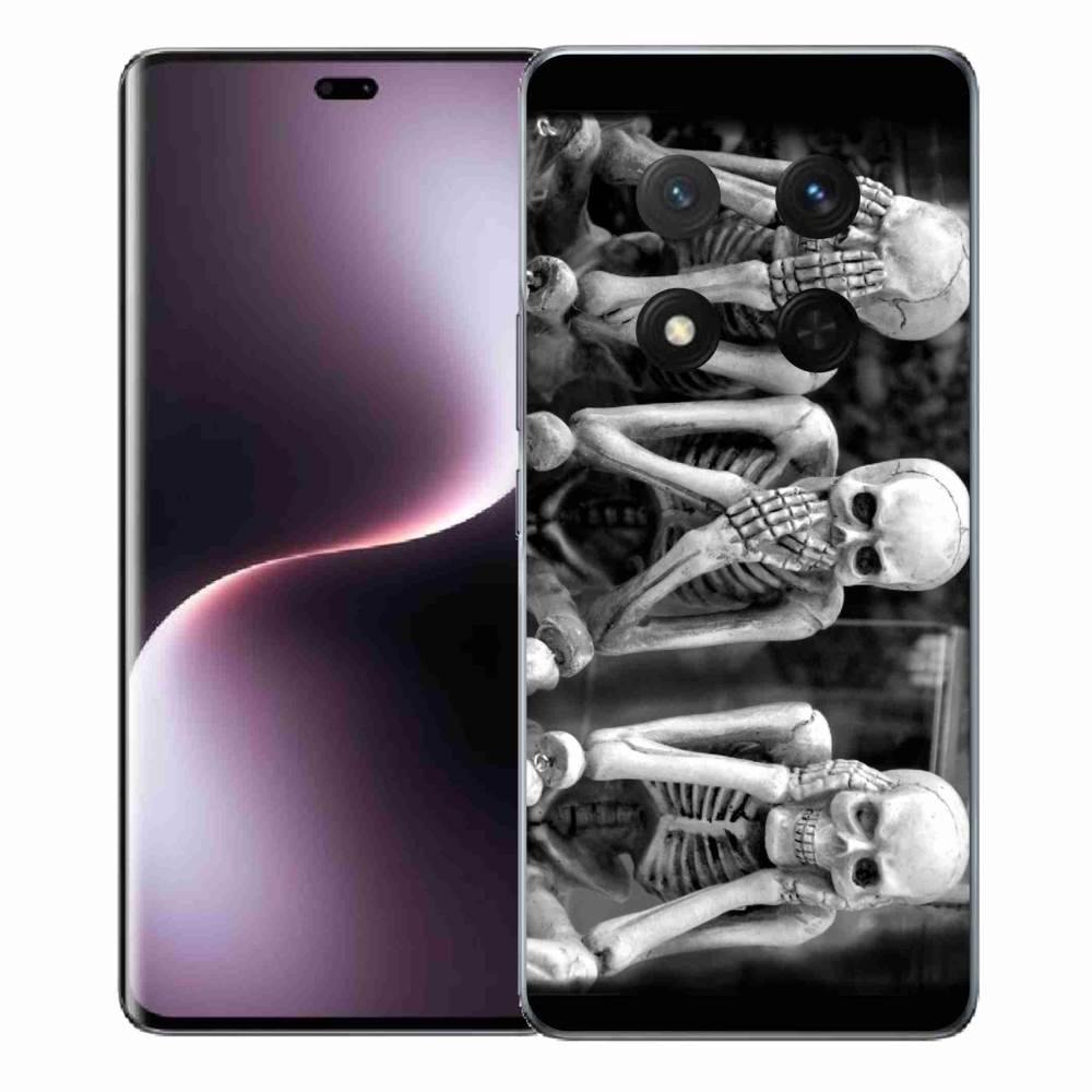 Gél borítás mmCase a Honor Magic 7 Lite 5G számára - csontvázak