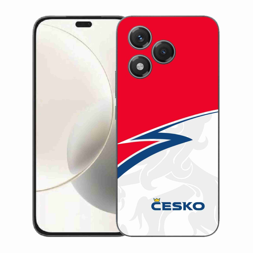 Zselés borítás mmCase a Honor 400 Lite-hoz - Csehország