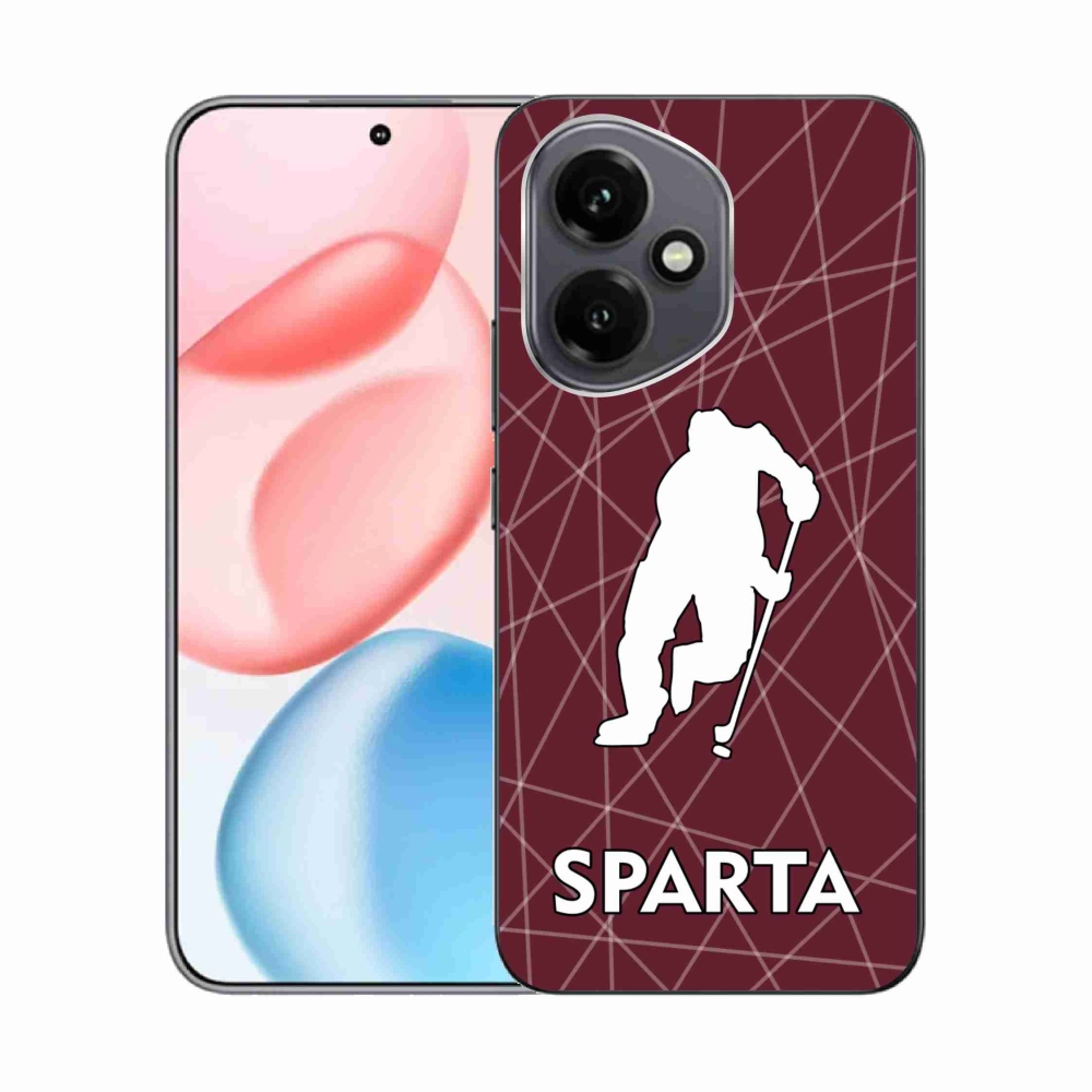 Zselés borítás mmCase a Honor 400-hoz - Sparta