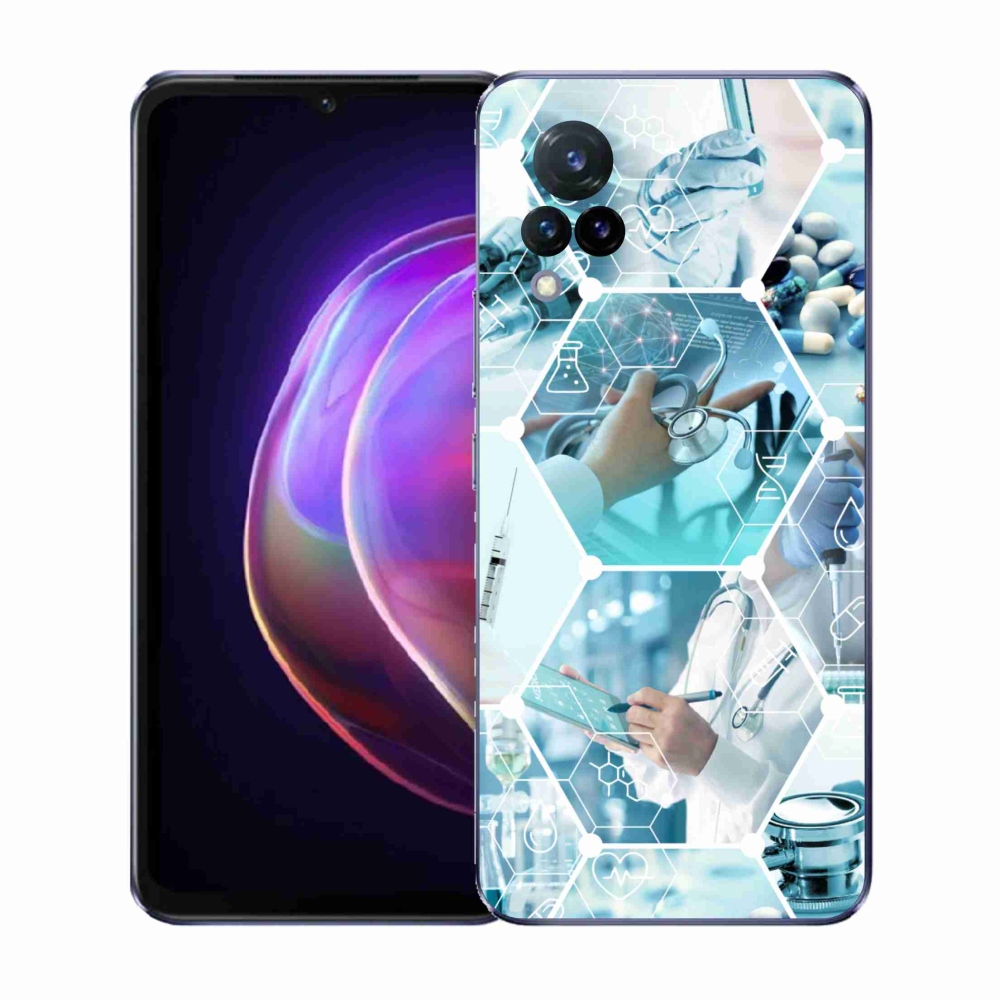 Gélburkolat mmCase a Vivo V21 4G/5G készüléken - egészség