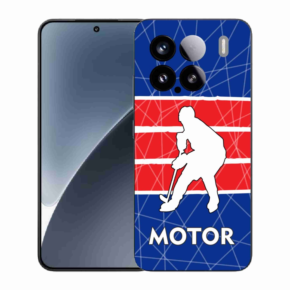 Gél borítás mmCase a Xiaomi 15 - Motorhoz