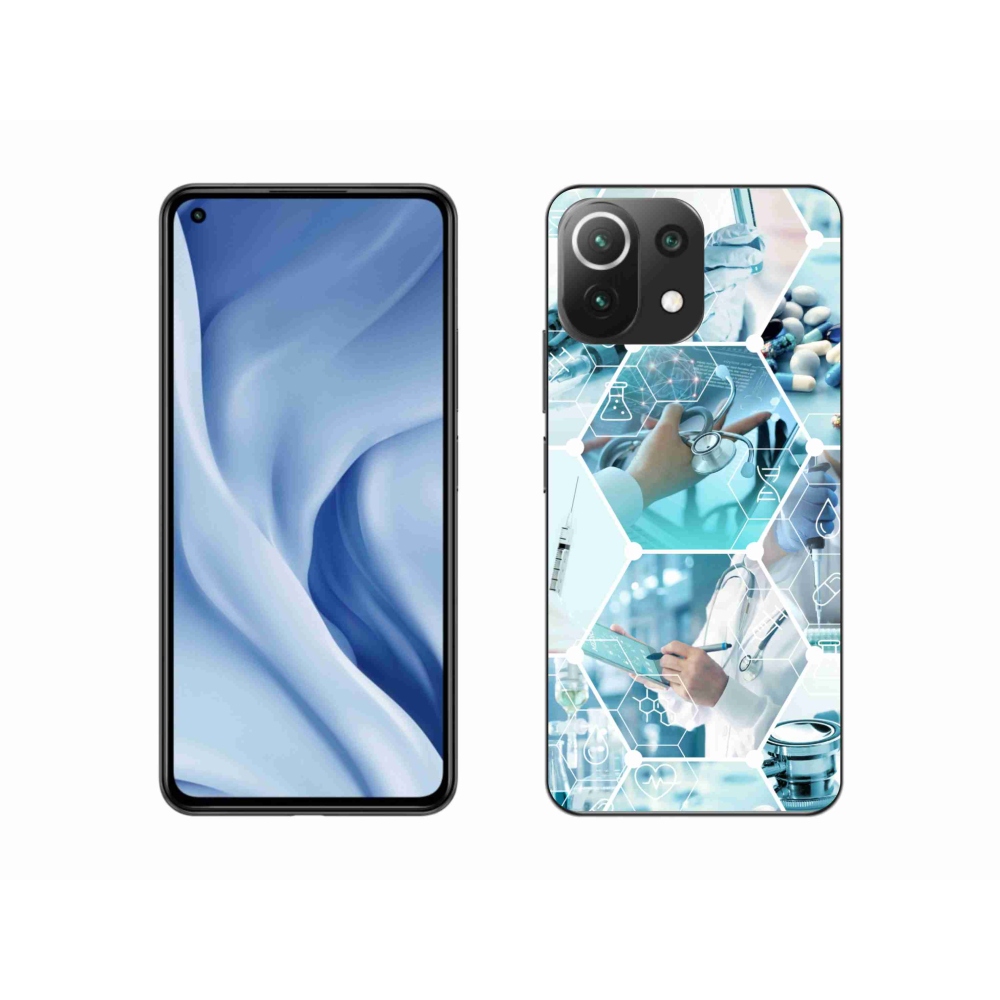 Gél borítás mmCase a Xiaomi Mi 11 Lite 4G/5G számára - egészség