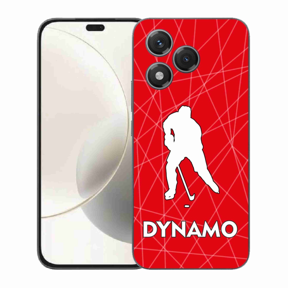 Zselés borítás mmCase a Honor 400 Lite-hoz - Dynamo 2