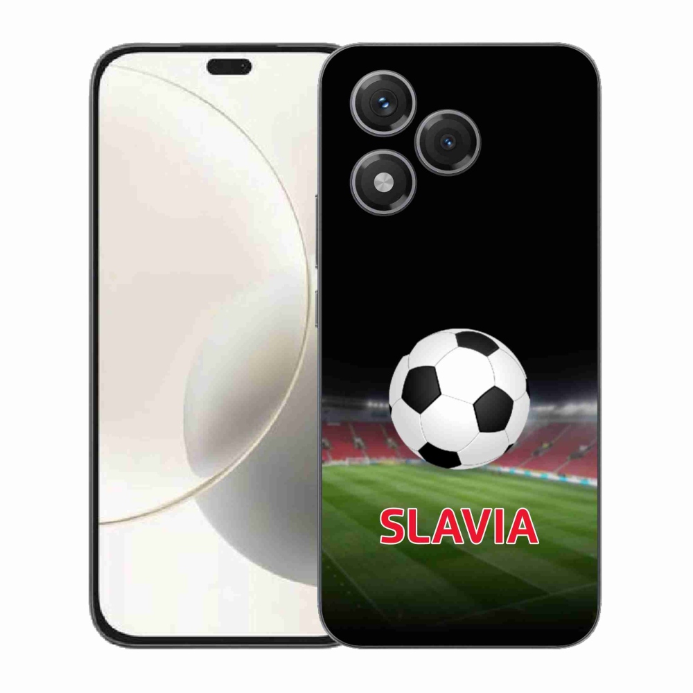 Zselés borítás mmCase a Honor 400 Lite készülékhez - slavia 1