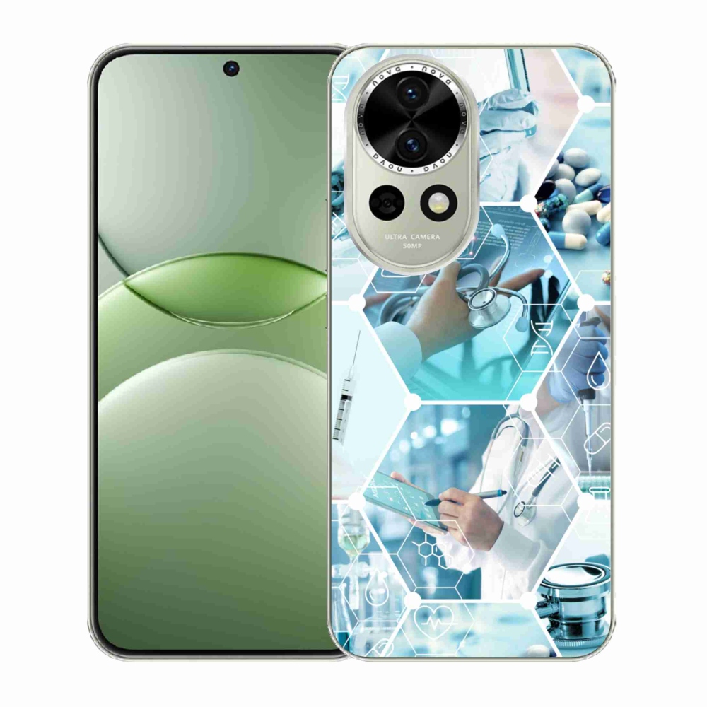 Gél borítás mmCase a Huawei Nova 13 5G-n - egészség