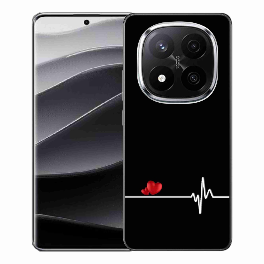 Gél borítás mmCase a Xiaomi Redmi Note 14 Pro+ 5G számára - szív és szívverés fekete háttérrel