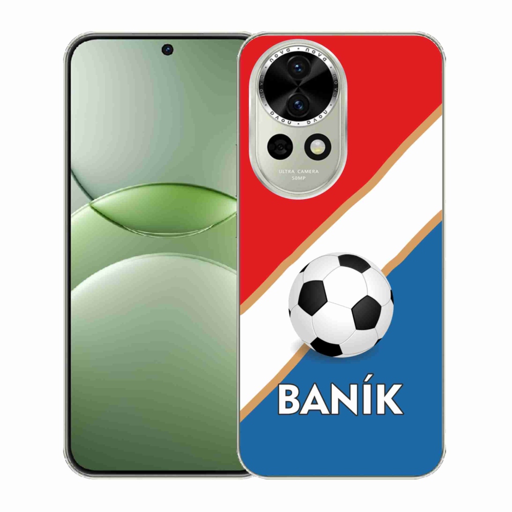 Zselés borítás mmCase a Huawei Nova 13 5G-n - Baník