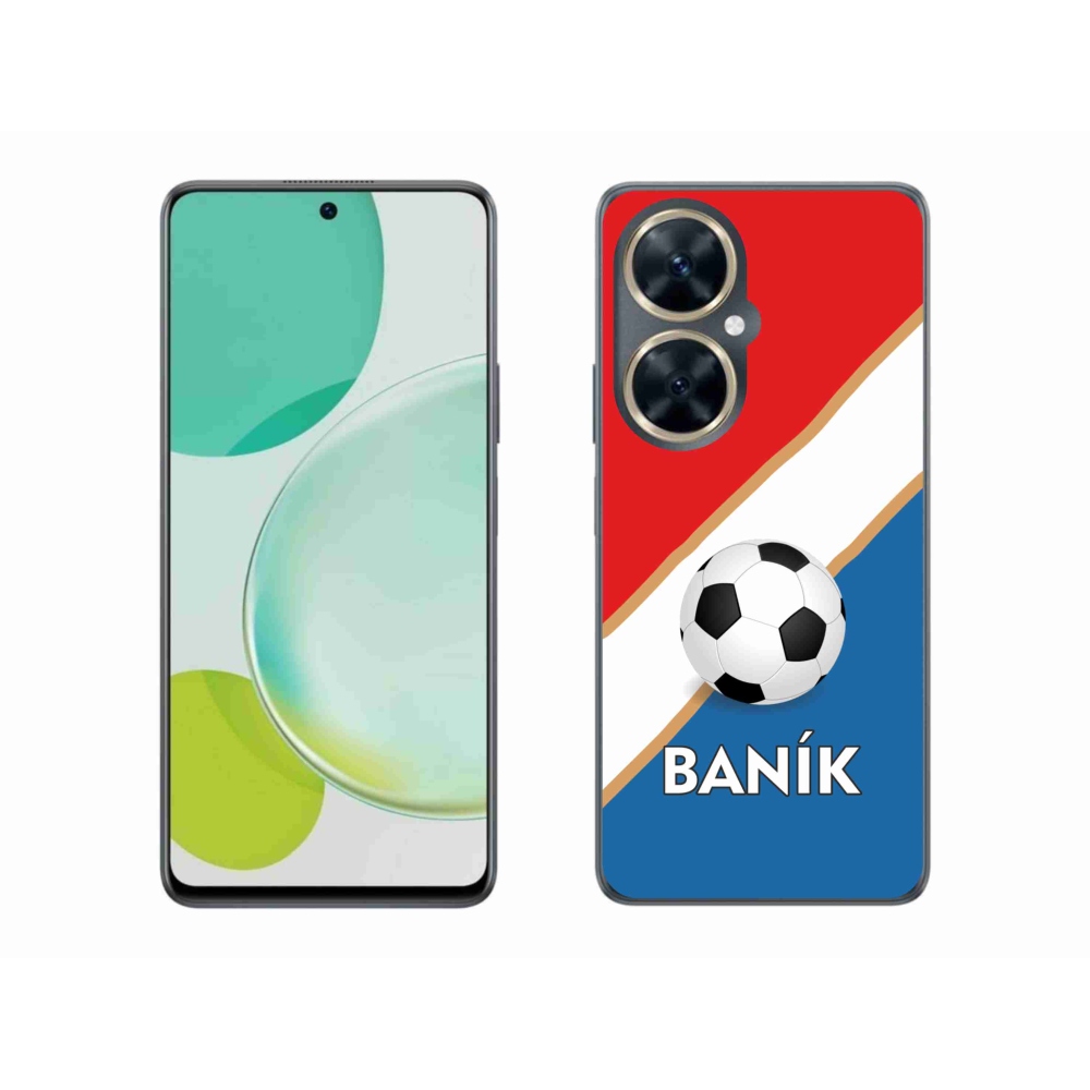 Gél borítás mmCase a Huawei Nova 11i készülékre - Baník