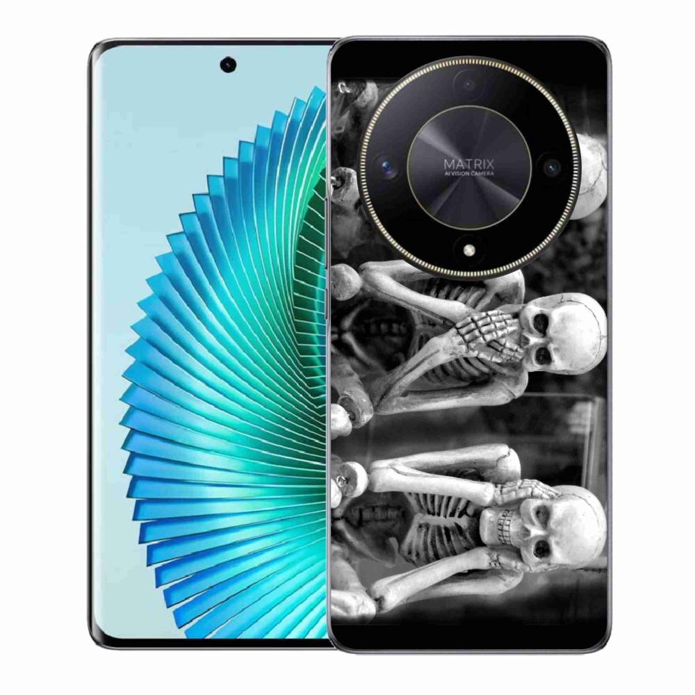 Zselés borítás mmCase a Honor Magic 6 Lite 5G számára - csontvázak