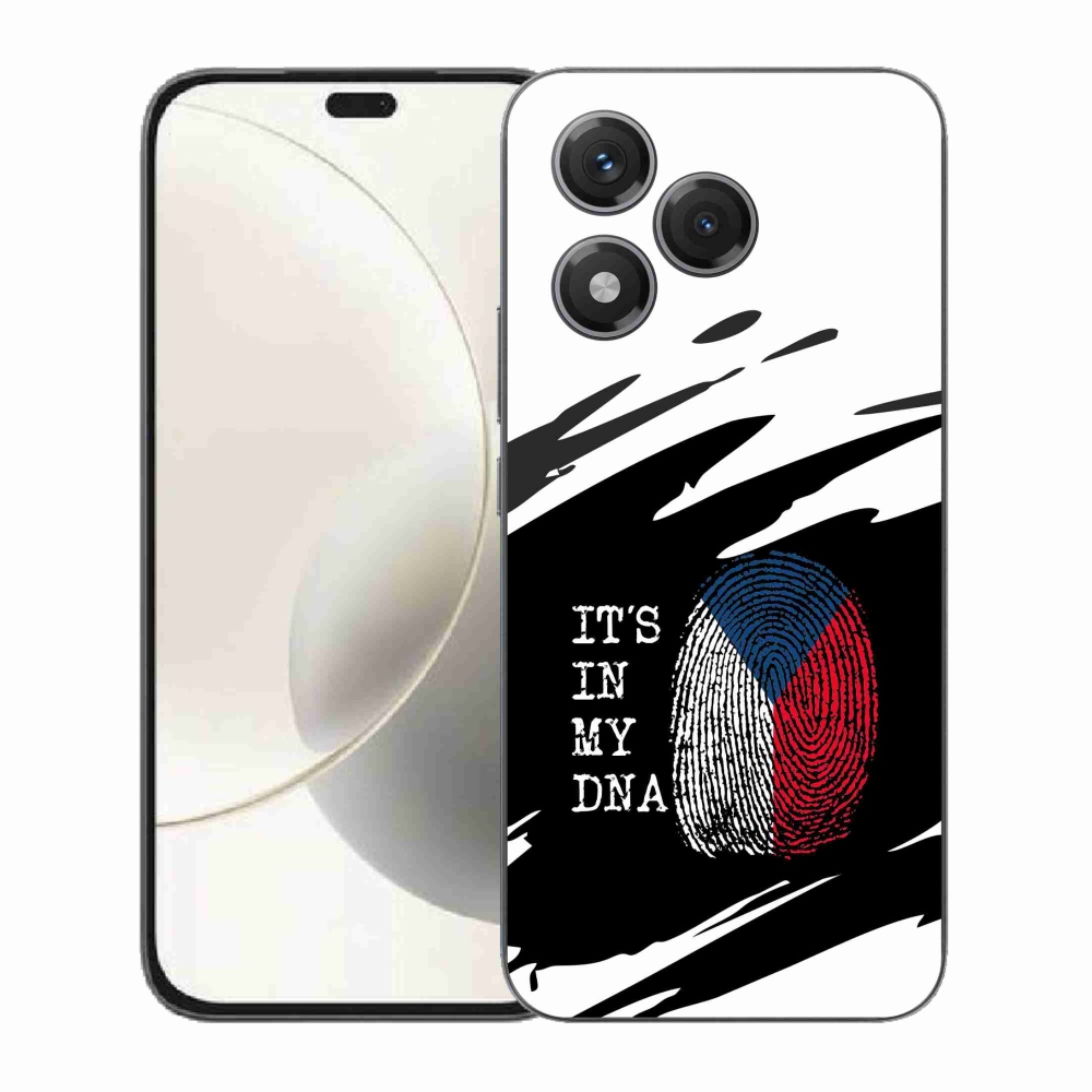 Zselés borító mmCase a Honor 400 Lite-hoz - zászlós ujjlenyomat fekete és fehér háttérrel