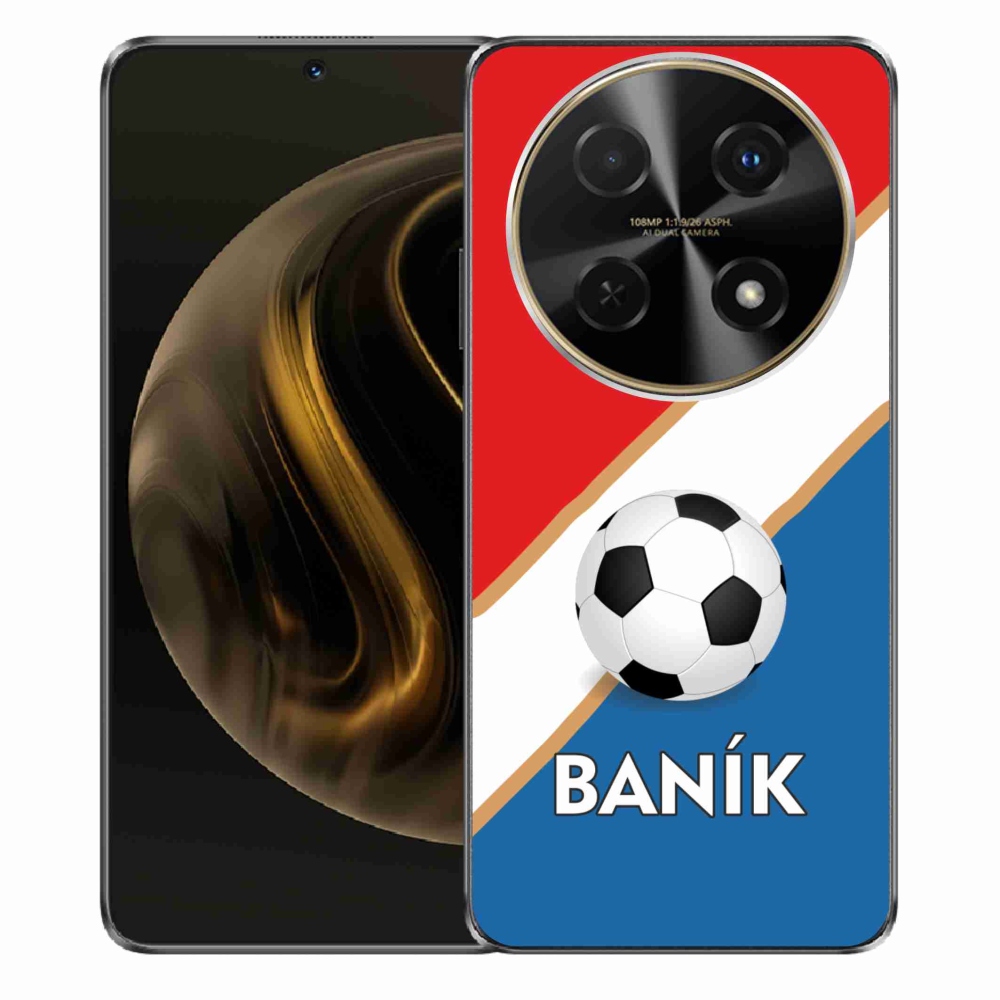 Gél védőhuzat mmCase a Huawei Nova 12i készülékhez - Baník