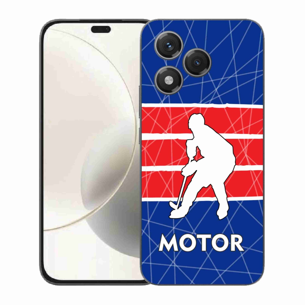 Zselés borítás mmCase a Honor 400 Lite készülékhez - Motor