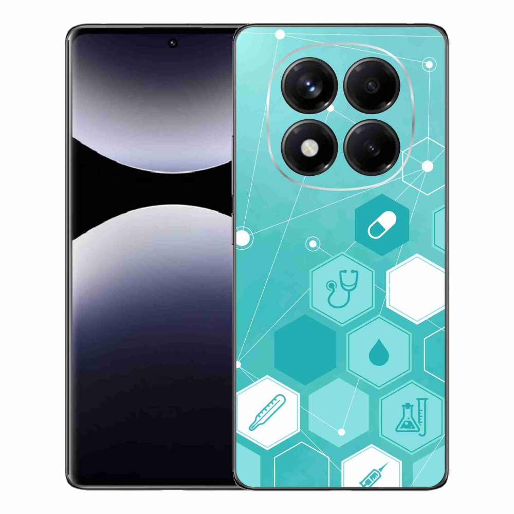 Gél borítás mmCase a Xiaomi Redmi Note 14 Pro számára - egészség 3