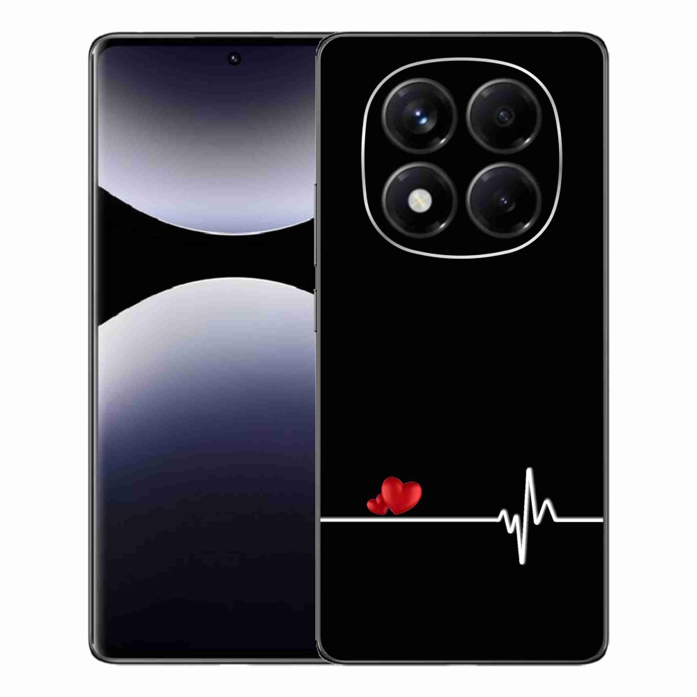 Gél borítás mmCase a Xiaomi Redmi Note 14 Pro számára - szív és szívverés fekete háttérrel