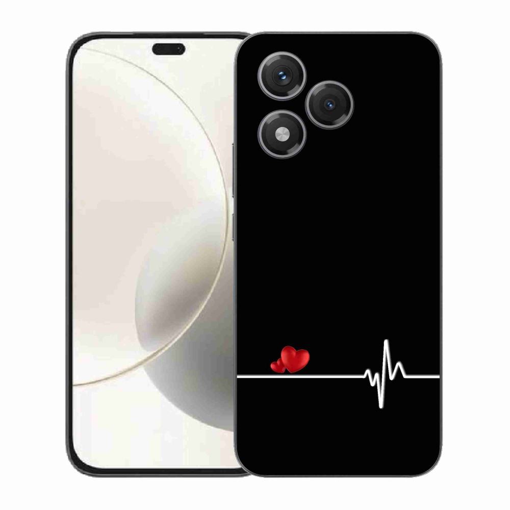 Gél borító mmCase a Honor 400 Lite-hoz - szív és szívverés fekete háttérrel