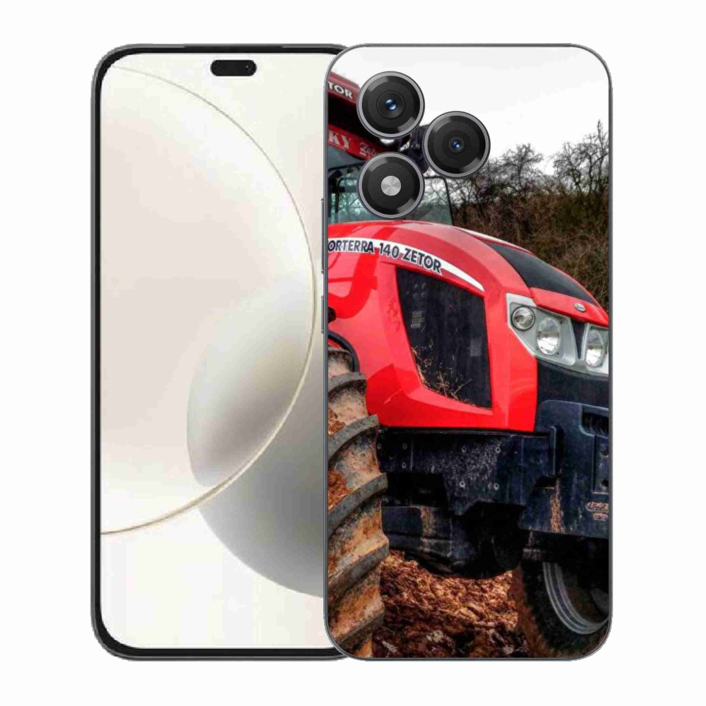 Zselés borítás mmCase a Honor 400 Lite-hoz - zetor