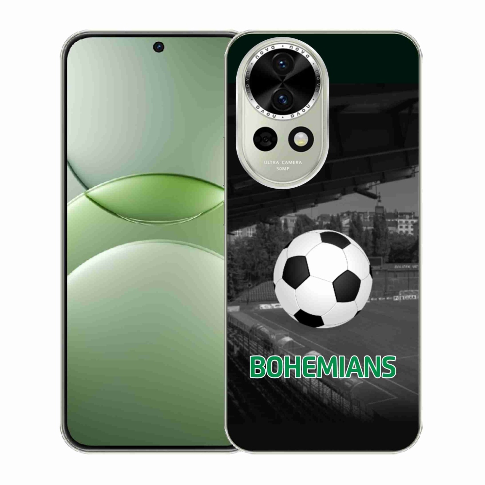 Gél borítás mmCase a Huawei Nova 13 5G-n - bohémek 2