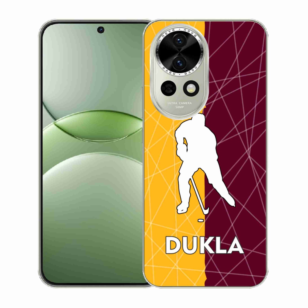 Gél borítás mmCase a Huawei Nova 13 5G-n - Dukla