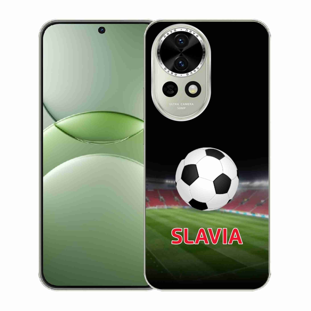 Gél borítás mmCase a Huawei Nova 13 5G-n - slavia 1