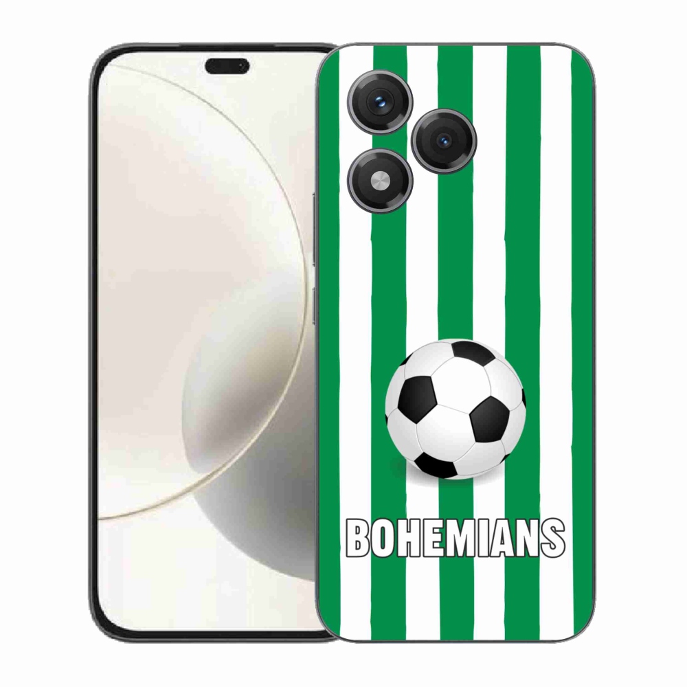 Zselés borítás mmCase a Honor 400 Lite-hoz - Bohemians