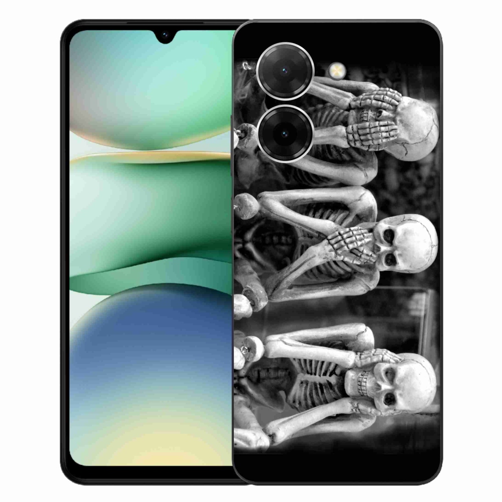 Gél borítás mmCase a Xiaomi Redmi A5 (171.7x77.8x8.3mm) - csontvázakhoz