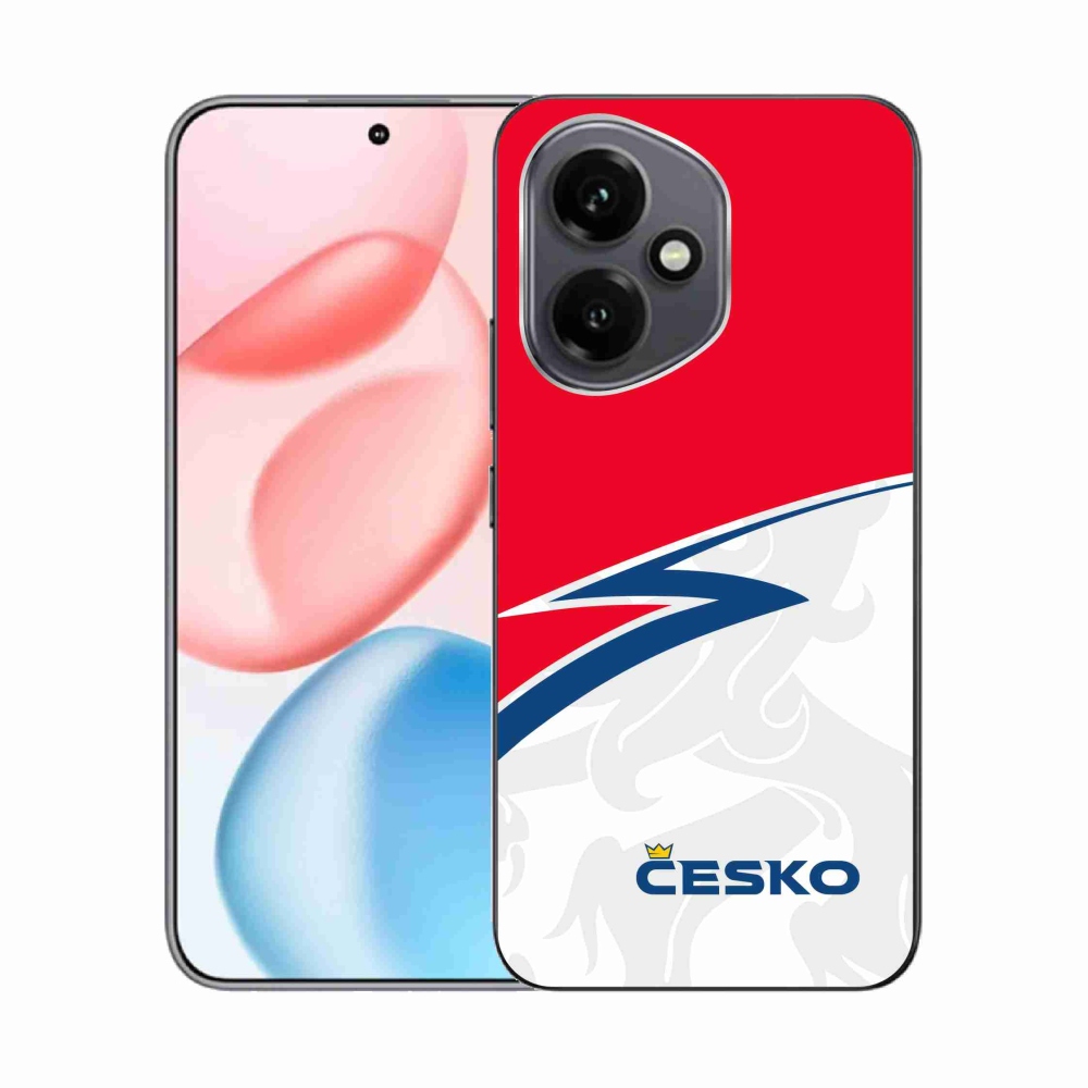 Zselés borítás mmCase a Honor 400-hoz - Kanada