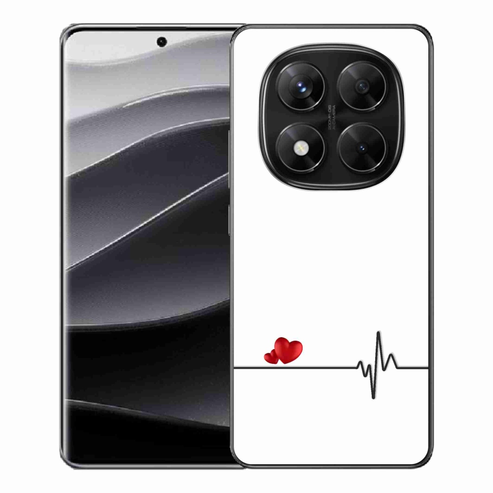 Gél borítás mmCase a Xiaomi Redmi Note 14 Pro 5G/Poco X7 5G számára - szív és szívverés fehér háttérrel