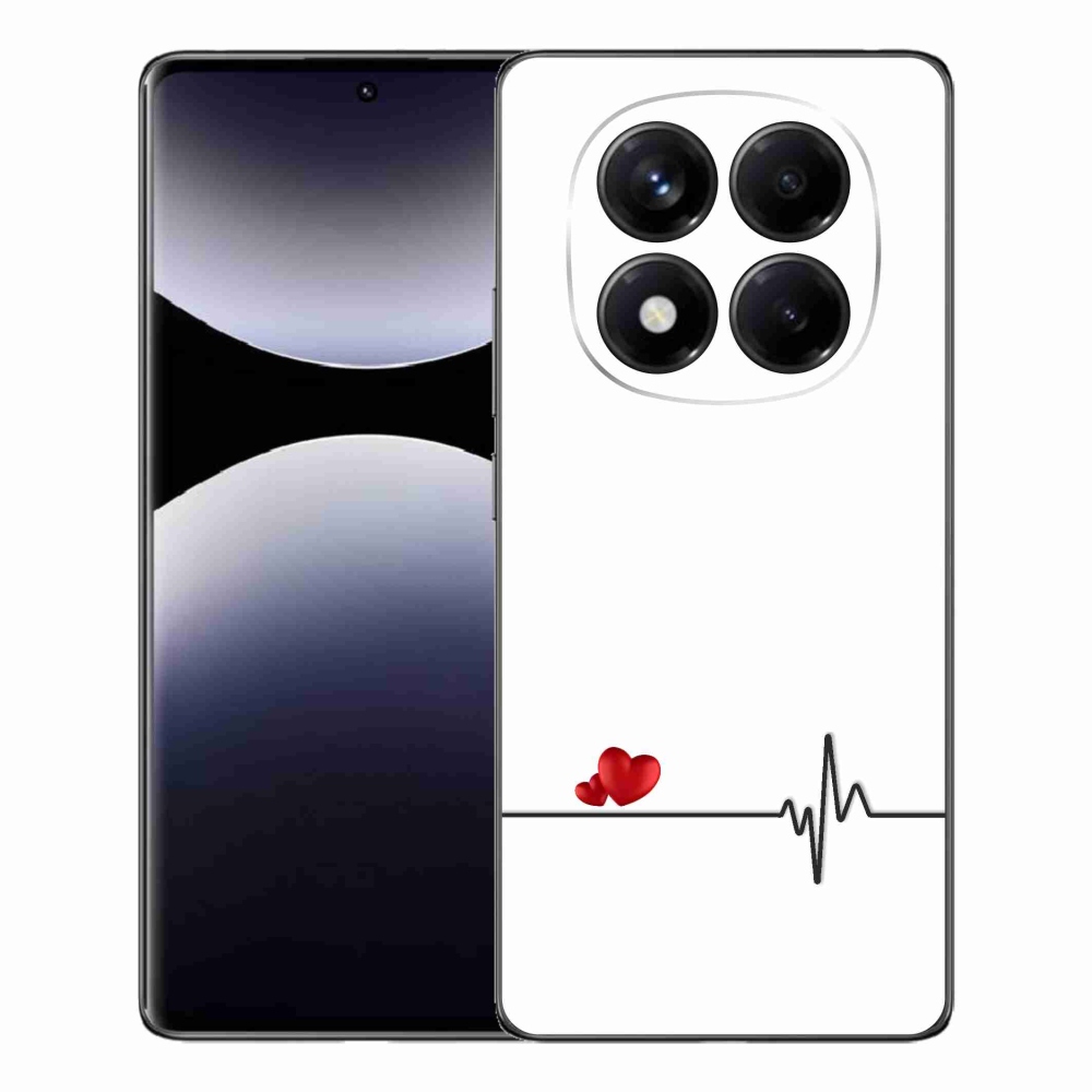 Gél borító mmCase a Xiaomi Redmi Note 14 Pro számára - szív és szívverés fehér háttérrel