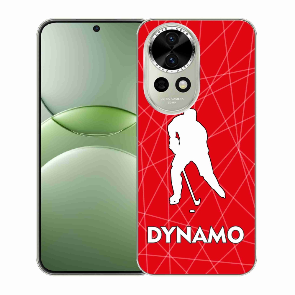 Gél borítás mmCase a Huawei Nova 13 5G - Dynamo 2 készülékre