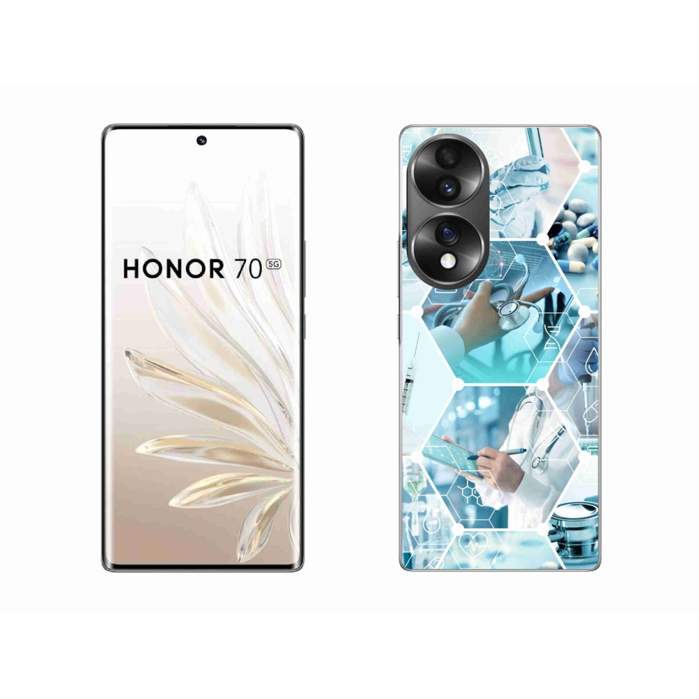 Gel Cover mmCase mmCase for Honor 70 - Egészségügy