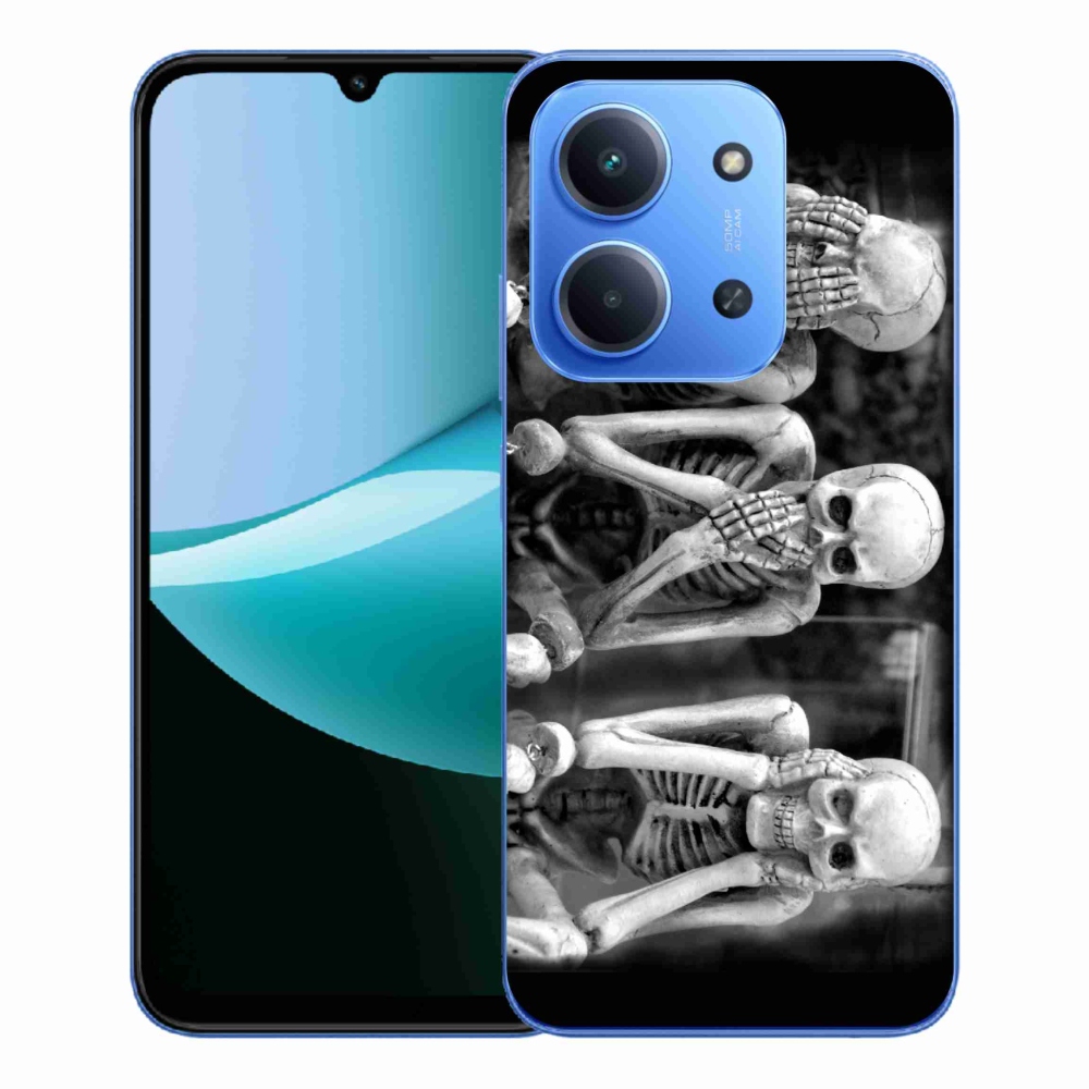 Gél borítás mmCase a Xiaomi Redmi 15C 4G/5G (173mm) - csontvázakhoz