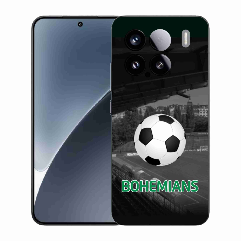 Gél borítás mmCase a Xiaomi 15-öshöz - bohémek 2