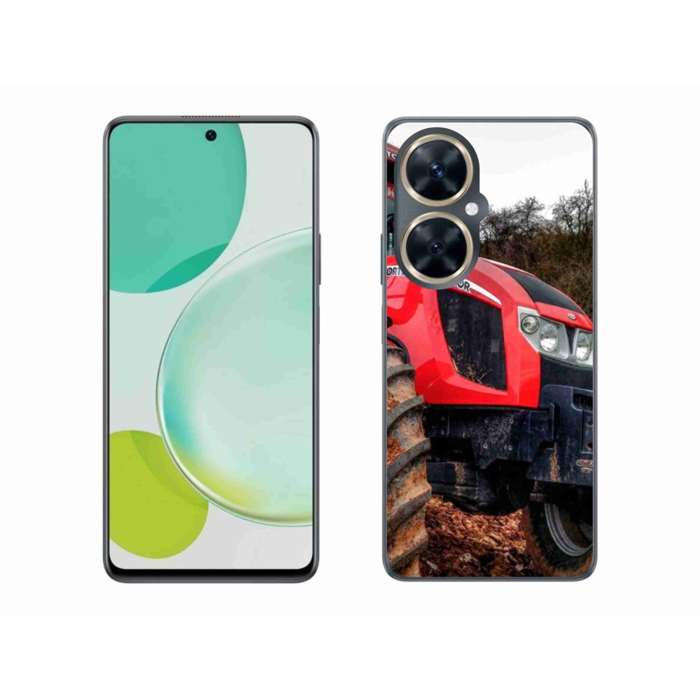 Gél borítás mmCase a Huawei Nova 11i készülékhez - zetor