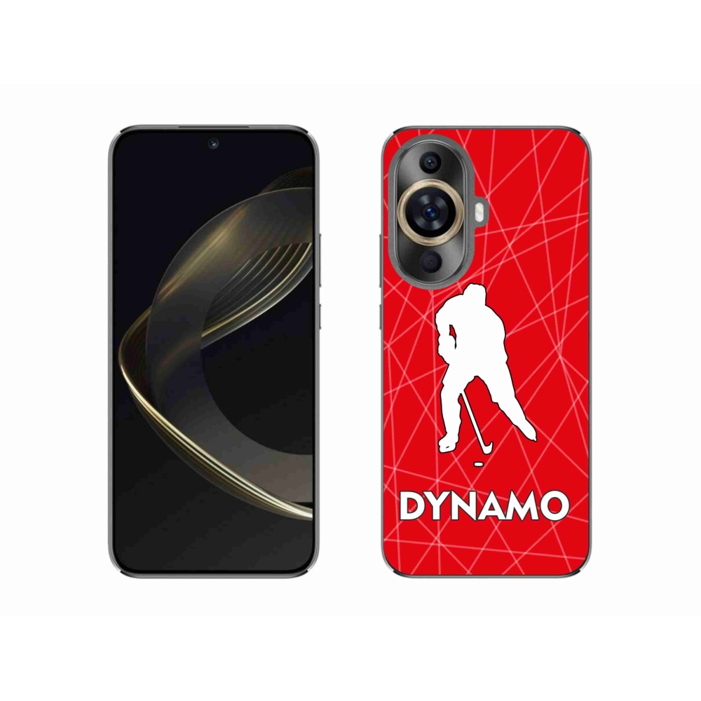 Gél borítás mmCase a Huawei Nova 11 készülékhez - Dynamo 2