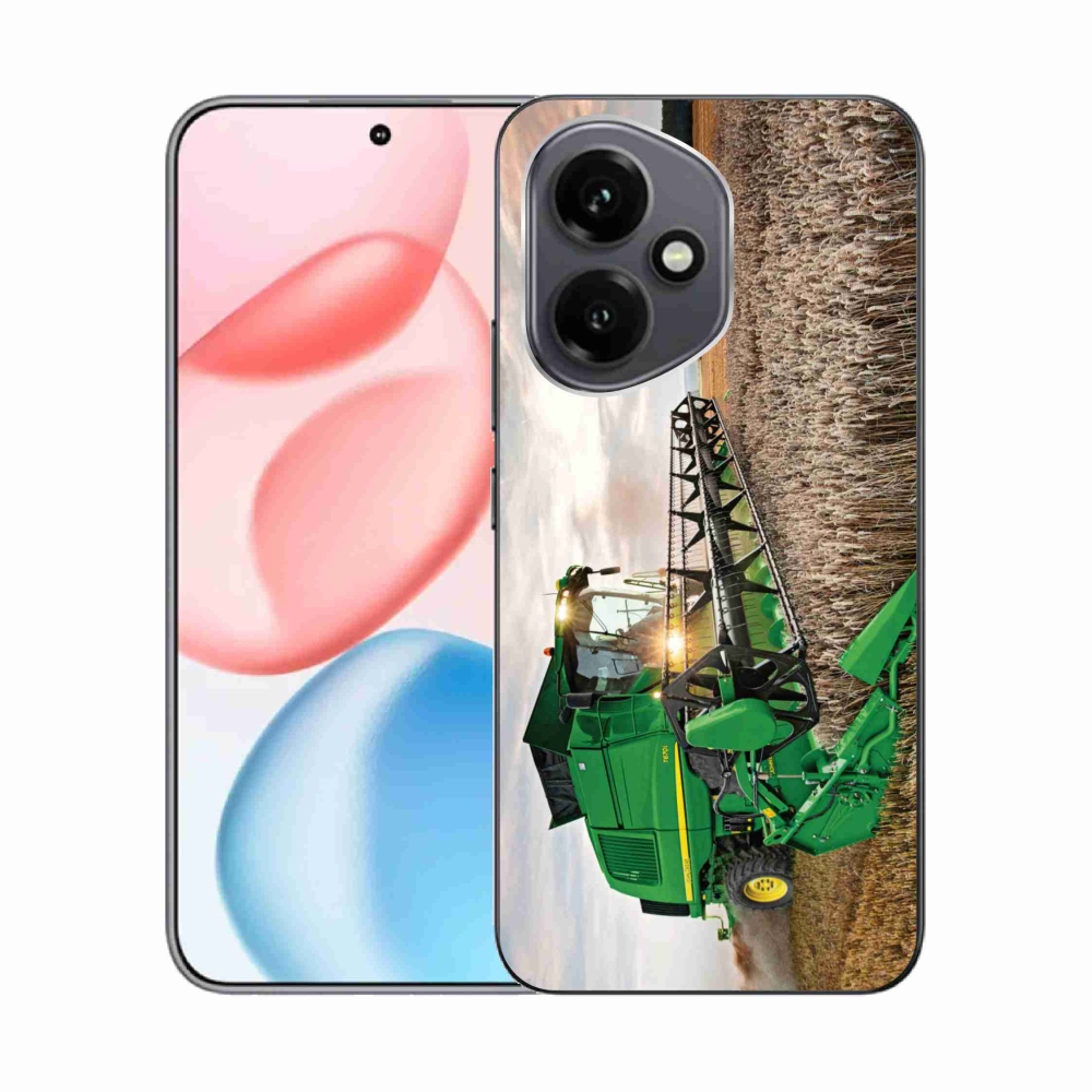 Zselés borítás mmCase a Honor 400-hoz - kombinálni