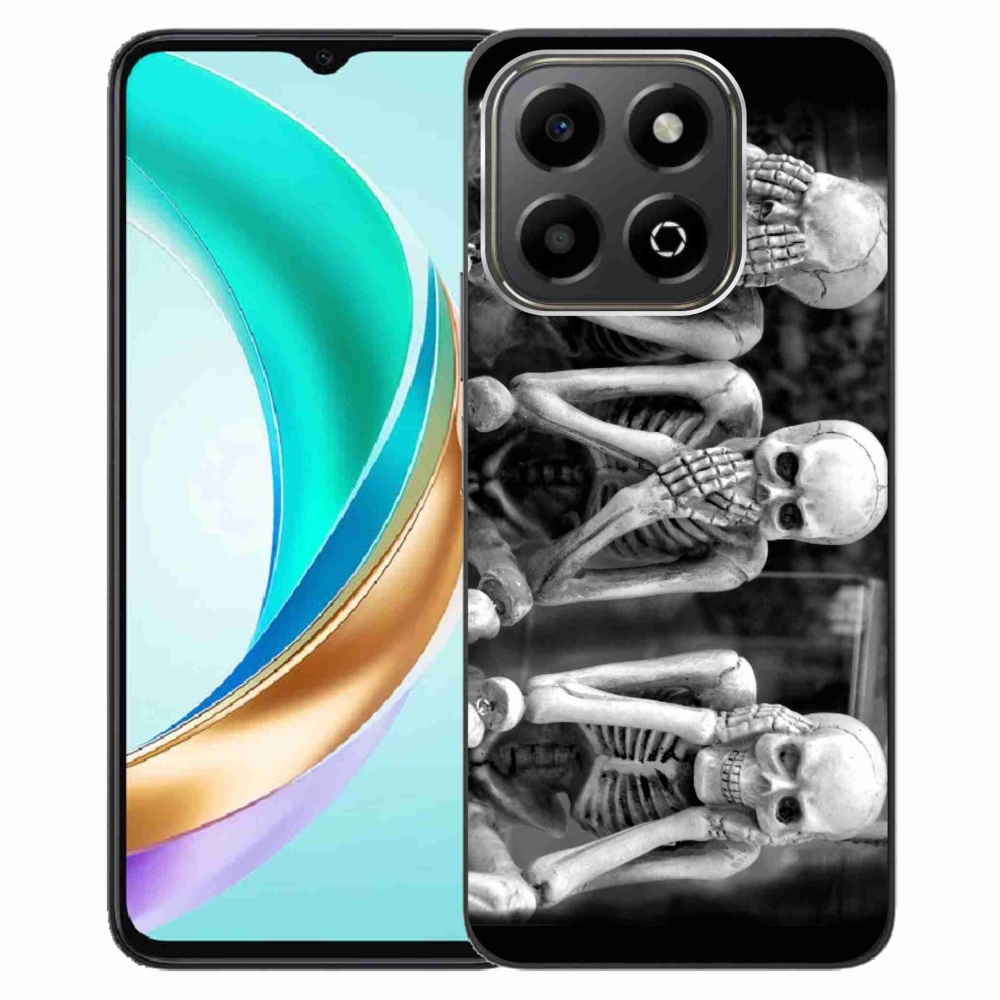 Zselés borítás mmCase a Honor X6b készülékhez - vázszerkezetek