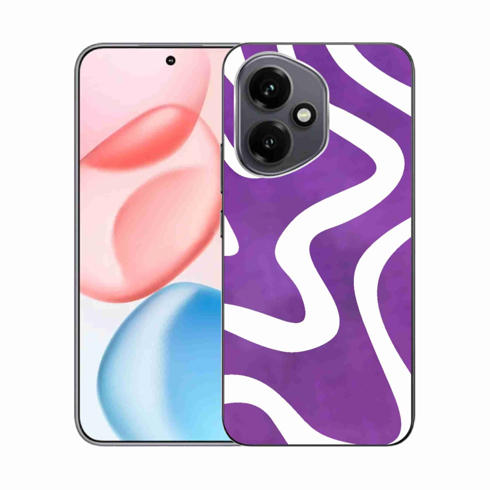 Zselés borítás mmCase a Honor 400-hoz - kivonat 30